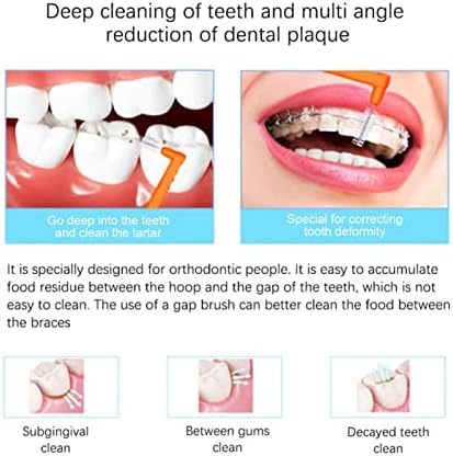 Меѓудетални четки од 5 парчиња агол, интердентални четки во облик на L помеѓу забите и непцата, микро -чистач на четка, отстранување