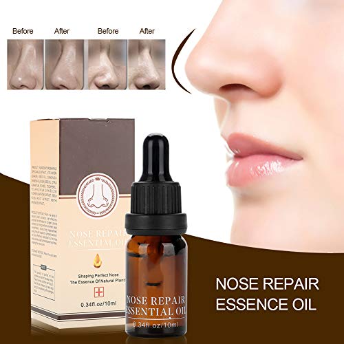 Носот Подигнете Го Обликувањето На Есенцијалното Масло, Професионалниот Нос Ја Зголемува Ринопластиката Серум За Ремоделирање На Носната
