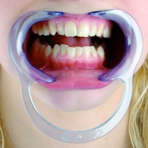 Афродит 20 парчиња Ц-облик на возрасни заби за заби за заби во интраорална образ усна ретактор за уста, средна големина