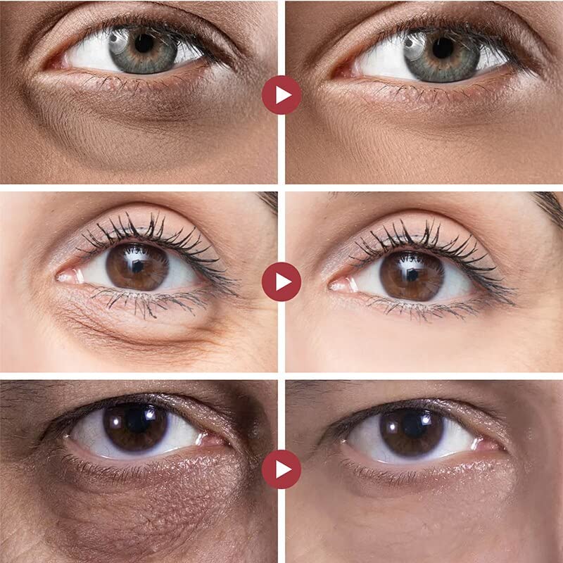 Отстранува масни гранули, крем за очи Подобрете ја торбата за очи Темни фини линии кревајќи зацврстување на навлажнувачки анти-истуренски козметика на окото 去 除脂