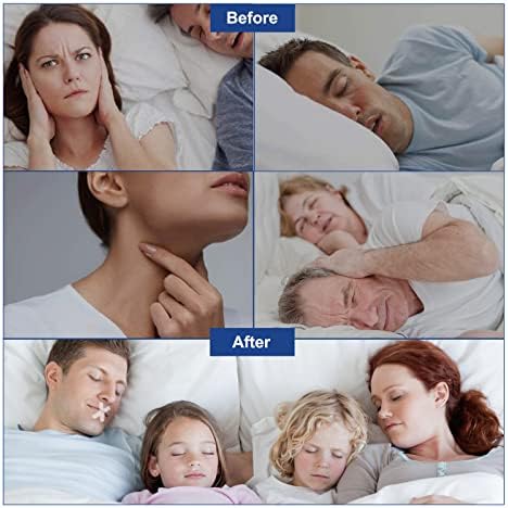 QTO лента за уста за спиење 120 броеви, ноќно спиење подобро дишење на носот, ленти за спиење за апнеја на спиење, дишење на устата и гласно
