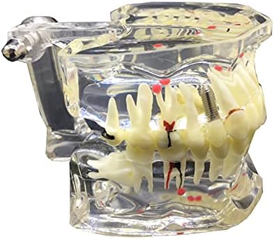 KH66ZKY Стоматолошки орален типодонт модел - Стоматолошка студија Настава модел на заби - модел за типодонт за возрасни за студија