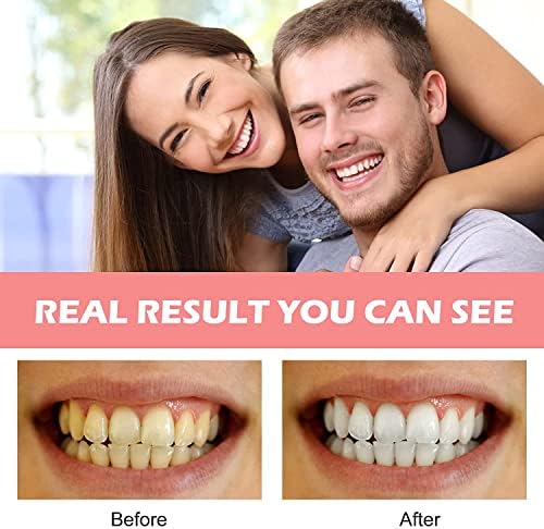 Лажни заби, 2 парчиња заби за заби за жени и мажи, стоматолошки фурнири за привремена реставрација на забите, природа и удобно, заштитете ги забите и вратете ја сигур
