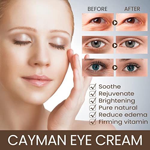 Dbylxmn Heheba Oil Eye Eye Carty Eye Tagks за да избледи линии на очите за да го осветли дното на очето на кожата боја на очите сува