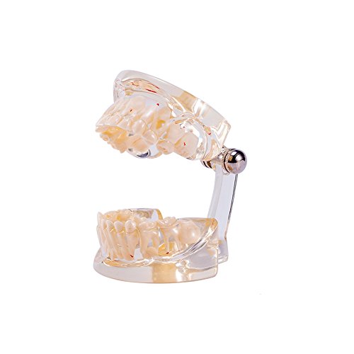 Модел на стоматолошка патологија SNAWOP ПЕДИАТРИЧКИ заби модел на чиста мешана возраст Детска болест Модел на заби
