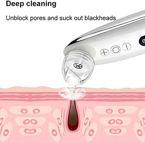 Heyuanpius blackhead vacuum комплет ， пори вакуум со камера -usb hermargeable blackhead екстрактор за жени мажи кои се соочуваат