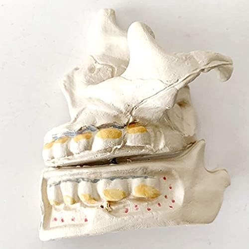 Лумекуба Стоматолошка Настава Споредба Серија Пародонтална Уста Нега Анатомија Модел Медицински Модел