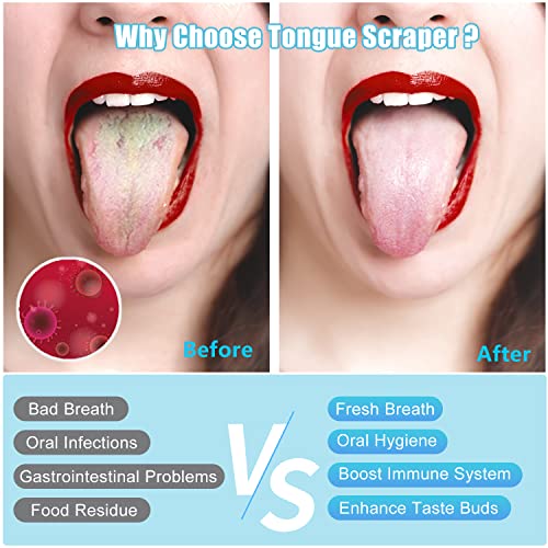 Scraper на јазик, Morgles 4PCS чистач за чистење на јазици со случајот Медицински одделение од не'рѓосувачки челични јазици за