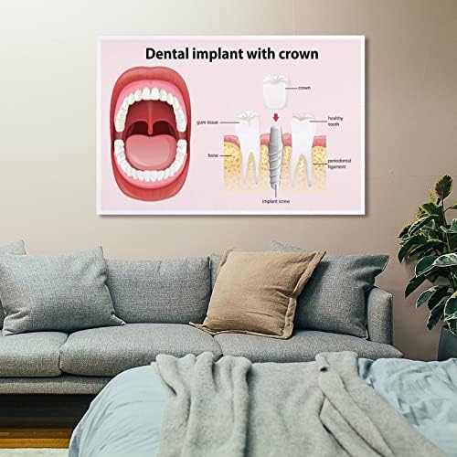 Заби за стоматолошки имплантација на стоматолошки постер за стоматолошка клиника постер плака за сликарство, сликарска уметност постер за