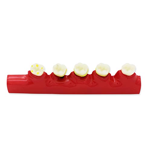 Модел на заби Д-ПЕ, Модел на заби за заби на заби